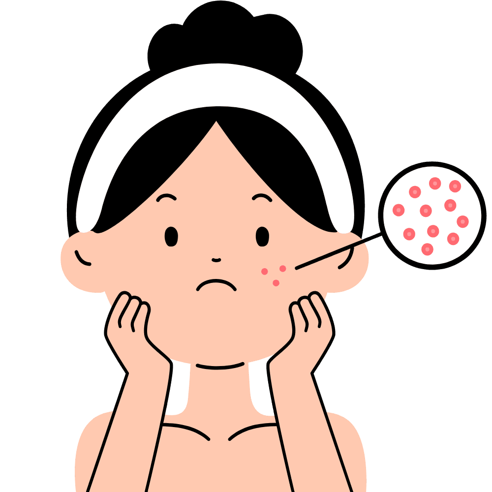Zoom sur les imperfections de la peau d’une jeune fille